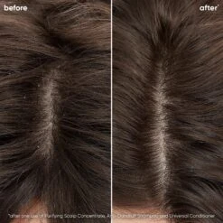 Matrix Biolage Scalp Sync Anti-Dandruff Shampoo -Bumble Sale Store Biolage Scalp Sync Anti Dandruff Shampoo13 1874cb93 cc78 415a a69a 31ca4966285a