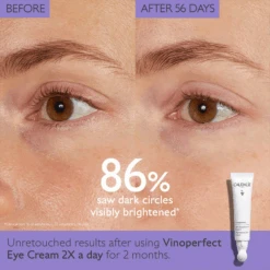 Caudalie Vinoperfect Dark Circle Brightening Eye Cream With Niacinamide -Bumble Sale Store Caudalie Vinoperfect Dark Circle Brightening Eye Cream 4