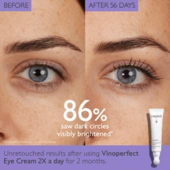 Caudalie Vinoperfect Dark Circle Brightening Eye Cream With Niacinamide -Bumble Sale Store Caudalie Vinoperfect Dark Circle Brightening Eye Cream f56677e2 b488 482d 8576 f1c3653a9ed0