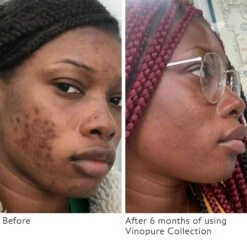 Caudalie Vinopure Pore Purifying Gel Cleanser -Bumble Sale Store Caudalie Vinopure Pore Purifying Gel Cleanser 1