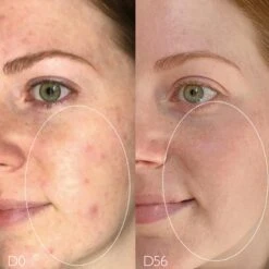 Caudalie Vinopure Skin Perfecting Mattifying Fluid -Bumble Sale Store Caudalie Vinopure Skin Perfecting Mattifying Fluid 2