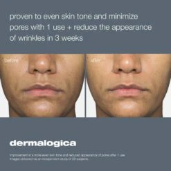 Dermalogica Liquid Peelfoliant -Bumble Sale Store Dermalogica Liquid Peelfoliant 1