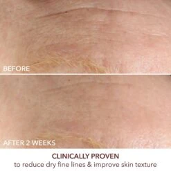 Dr Dennis Gross Advanced Retinol + Ferulic Intense Wrinkle Cream 16 Dr Dennis Gross Advanced Retinol + Ferulic Intense Wrinkle Cream -Bumble Sale Store Dr.Dennis Gross Advanced Retinol Ferulic Intense Wrinkle Cream