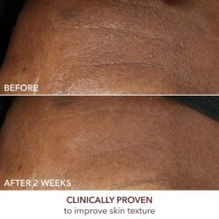 Dr Dennis Gross Advanced Retinol + Ferulic Intense Wrinkle Cream 18 Dr Dennis Gross Advanced Retinol + Ferulic Intense Wrinkle Cream -Bumble Sale Store Dr.Dennis Gross Advanced Retinol Ferulic Intense Wrinkle Cream 2