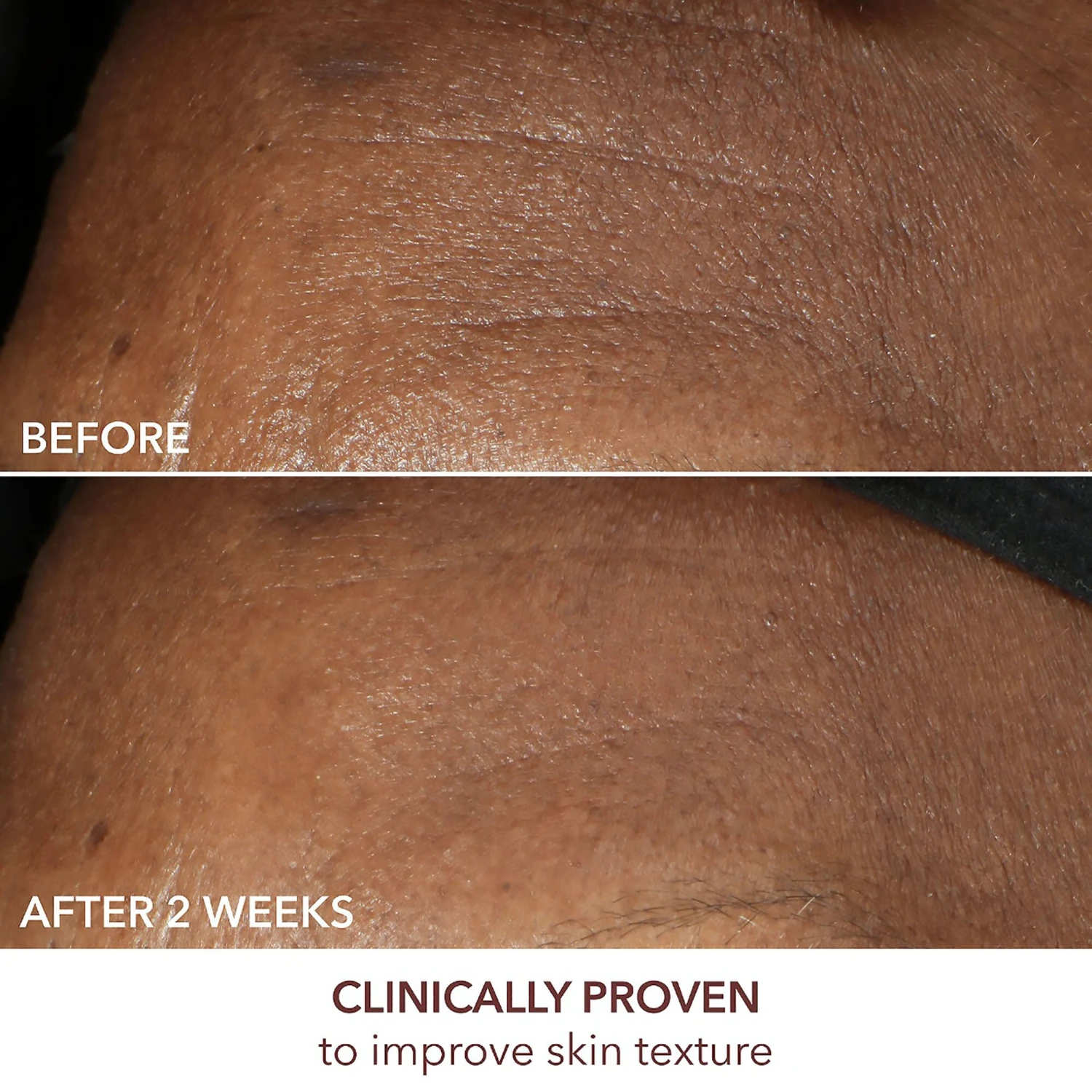 Dr Dennis Gross Advanced Retinol + Ferulic Intense Wrinkle Cream 10 Dr Dennis Gross Advanced Retinol + Ferulic Intense Wrinkle Cream - Image 8