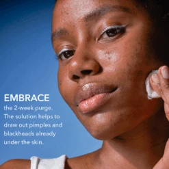 Dr Dennis Gross Dr. Dennis Gross Alpha Beta 2% BHA + Breakout Solution -Bumble Sale Store Dr.Dennis Gross Alpha Beta 2 BHA Breakout Solution 3