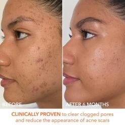 Dr Dennis Gross Dr. Dennis Gross Alpha Beta Extra Strength Daily Peel 60 Pk -Bumble Sale Store Dr.Dennis Gross Alpha Beta Extra Strength Daily Peel 30Pk 5 276810b1 99db 4c94 9656 70de97ad5782