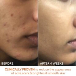 Dr Dennis Gross Dr. Dennis Gross Alpha Beta Extra Strength Daily Peel 60 Pk -Bumble Sale Store Dr.Dennis Gross Alpha Beta Extra Strength Daily Peel 30Pk 6 ddb2171d 4918 446b b4a0 f9d92cfc52c8