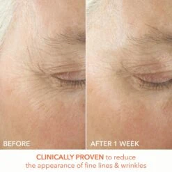 Dr Dennis Gross Dr. Dennis Gross Alpha Beta Ultra Gentle Daily Peel - 30 Applications 21 Dr Dennis Gross Dr. Dennis Gross Alpha Beta Ultra Gentle Daily Peel - 30 Applications -Bumble Sale Store Dr.Dennis Gross Alpha Beta Ultra Gentle Daily Peel 30Applications 5