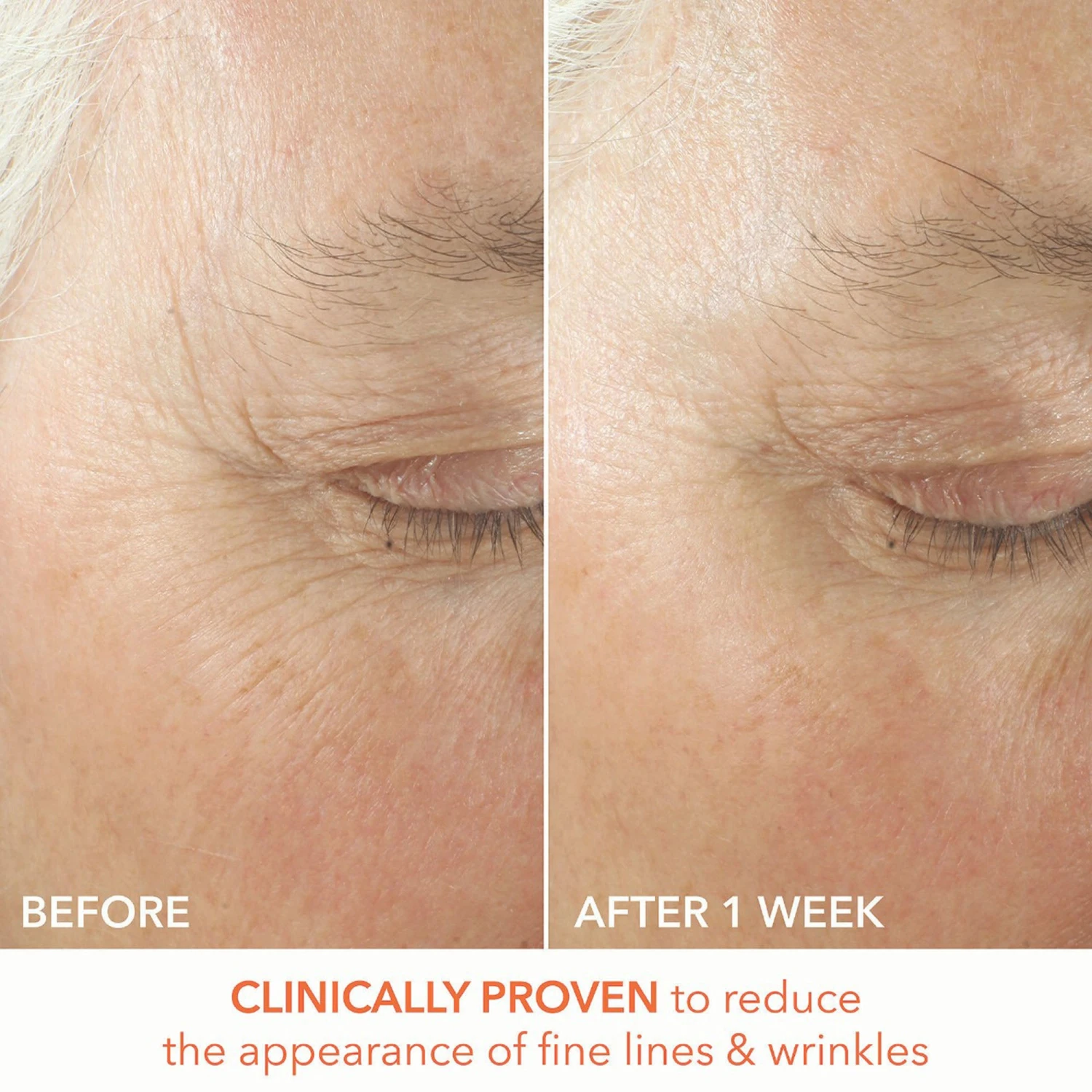 Dr Dennis Gross Dr. Dennis Gross Alpha Beta Ultra Gentle Daily Peel - 30 Applications 10 Dr Dennis Gross Dr. Dennis Gross Alpha Beta Ultra Gentle Daily Peel - 30 Applications - Image 8