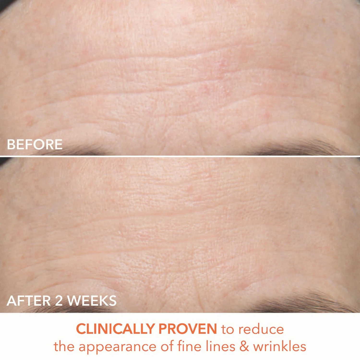 Dr Dennis Gross Dr. Dennis Gross Alpha Beta Ultra Gentle Daily Peel - 30 Applications 9 Dr Dennis Gross Dr. Dennis Gross Alpha Beta Ultra Gentle Daily Peel - 30 Applications - Image 7