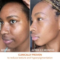 Dr Dennis Gross Dr. Dennis Gross Alpha Beta Universal Daily Peel 60 Pk 18 Dr Dennis Gross Dr. Dennis Gross Alpha Beta Universal Daily Peel 60 Pk -Bumble Sale Store Dr.Dennis Gross Alpha Beta Universal Daily Peel 60Pk 5