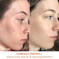 Dr Dennis Gross Dr. Dennis Gross Alpha Beta Universal Daily Peel 30 Pk 18 Dr Dennis Gross Dr. Dennis Gross Alpha Beta Universal Daily Peel 30 Pk -Bumble Sale Store Dr.Dennis Gross Alpha Beta Universal Daily Peel 60Pk 6 1fa8aa66 714f 4acc a7b9 b29e5e1f2920