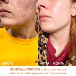 Dr Dennis Gross Dr. Dennis Gross Alpha Beta Universal Daily Peel 60 Pk 19 Dr Dennis Gross Dr. Dennis Gross Alpha Beta Universal Daily Peel 60 Pk -Bumble Sale Store Dr.Dennis Gross Alpha Beta Universal Daily Peel 60Pk 7