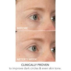 Dr Dennis Gross Dr. Dennis Gross DermInfusions Lift + Repair Eye Mask -Bumble Sale Store Dr.Dennis Gross DermInfusions Lift Repair Eye Mask