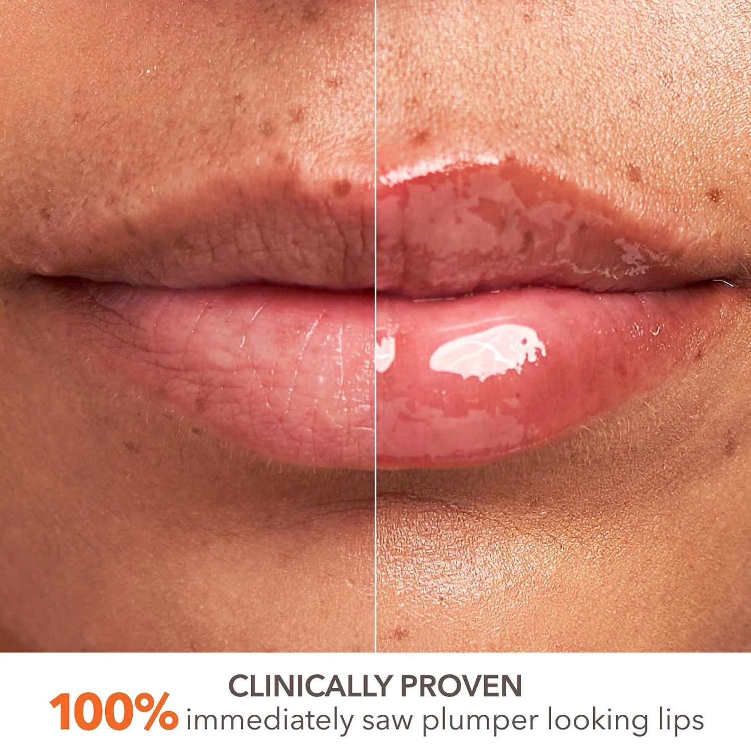 Dr Dennis Gross Dr. Dennis Gross DermInfusions Plump + Repair Lip Treatment 9 Dr Dennis Gross Dr. Dennis Gross DermInfusions Plump + Repair Lip Treatment - Image 7