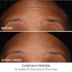 Dr Dennis Gross Dr. Dennis Gross Skincare DermInfusions Fill + Repair Serum -Bumble Sale Store Dr Dennis Gross Skincare DermInfusions Fill Repair Serum 3