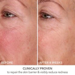 Dr Dennis Gross Dr. Dennis Gross Skincare DermInfusions Fill + Repair Serum -Bumble Sale Store Dr Dennis Gross Skincare DermInfusions Fill Repair Serum 4