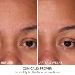 Dr Dennis Gross Dr. Dennis Gross Skincare DermInfusions Fill + Repair Serum -Bumble Sale Store Dr Dennis Gross Skincare DermInfusions Fill Repair Serum 5