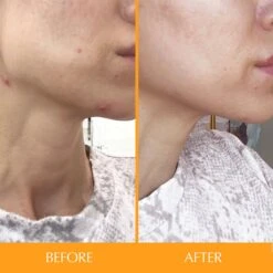 Hairtamin Skintamin Vitamins 10 Hairtamin Skintamin Vitamins -Bumble Sale Store Hairtamin Skintamin Vitamins 1