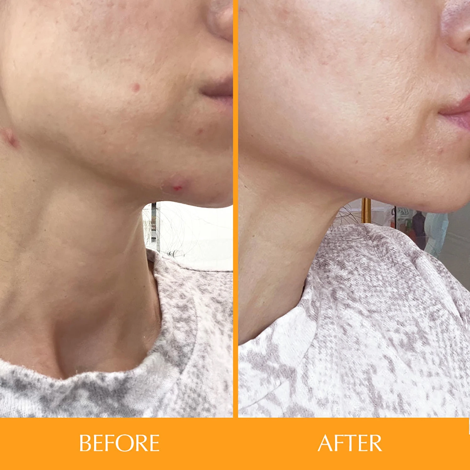 Hairtamin Skintamin Vitamins 5 Hairtamin Skintamin Vitamins - Image 3