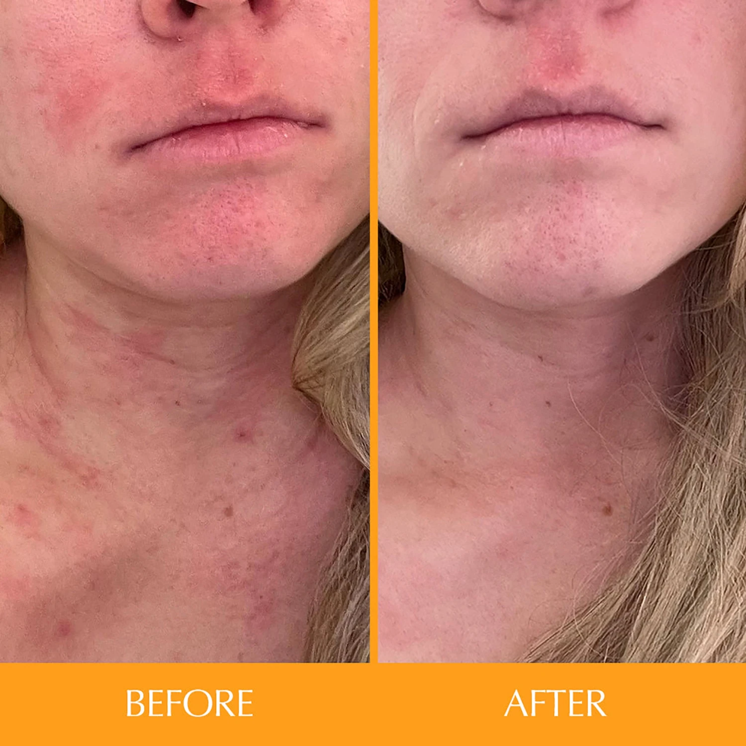 Hairtamin Skintamin Vitamins 6 Hairtamin Skintamin Vitamins - Image 4