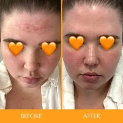 Hairtamin Skintamin Vitamins 12 Hairtamin Skintamin Vitamins -Bumble Sale Store Hairtamin Skintamin Vitamins 3