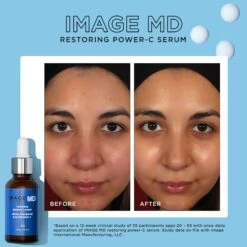 Image Skincare Image MD Restoring Power-C Serum 28 Image Skincare Image MD Restoring Power-C Serum -Bumble Sale Store Image Skincare Image MD Restoring Power C Serum ac256664 48d3 4e2b b9e0 43e28b723354