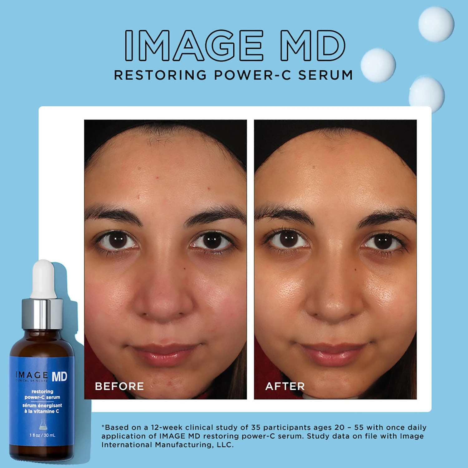 Image Skincare Image MD Restoring Power-C Serum 15 Image Skincare Image MD Restoring Power-C Serum - Image 13