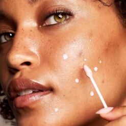 Kate Somerville EradiKate Acne Treatment -Bumble Sale Store Kate Somerville EradiKate Acne Treatment 1