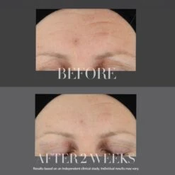 Kate Somerville KateCeuticals Firming Serum 13 Kate Somerville KateCeuticals Firming Serum -Bumble Sale Store Kate Somerville KateCeuticals Firming Serum 2