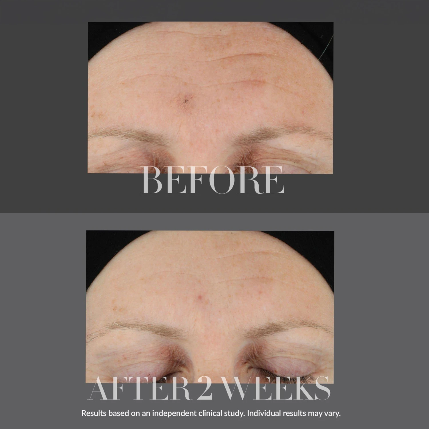 Kate Somerville KateCeuticals Firming Serum 8 Kate Somerville KateCeuticals Firming Serum - Image 6