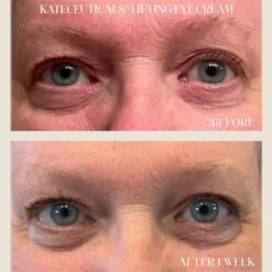 Kate Somerville KateCeuticals Lifting Eye Cream -Bumble Sale Store Kate Somerville KateCeuticals Lifting Eye Cream 2