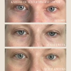 Kate Somerville KateCeuticals Lifting Eye Cream -Bumble Sale Store Kate Somerville KateCeuticals Lifting Eye Cream 3