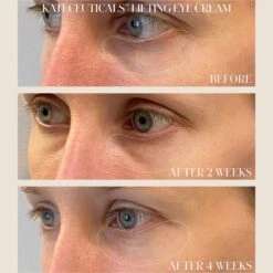 Kate Somerville KateCeuticals Lifting Eye Cream -Bumble Sale Store Kate Somerville KateCeuticals Lifting Eye Cream 4