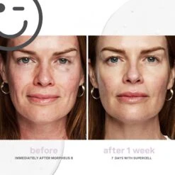 Kate Somerville KateCeuticals SuperCell Rejuvenation Serum -Bumble Sale Store Kate Somerville KateCeuticals SuperCell Rejuvenation Serum 2