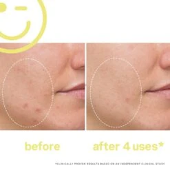 Kate Somerville Mega C 30% Vitamin C Brightening Facial -Bumble Sale Store Kate Somerville Mega C 30 Vitamin C Brightening Facial 1