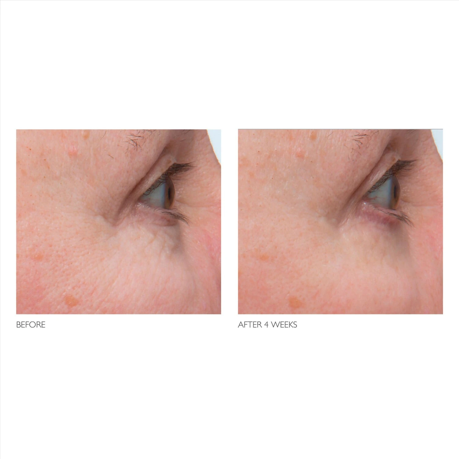 Kate Somerville + Retinol Firming Eye Cream 7 Kate Somerville + Retinol Firming Eye Cream - Image 5