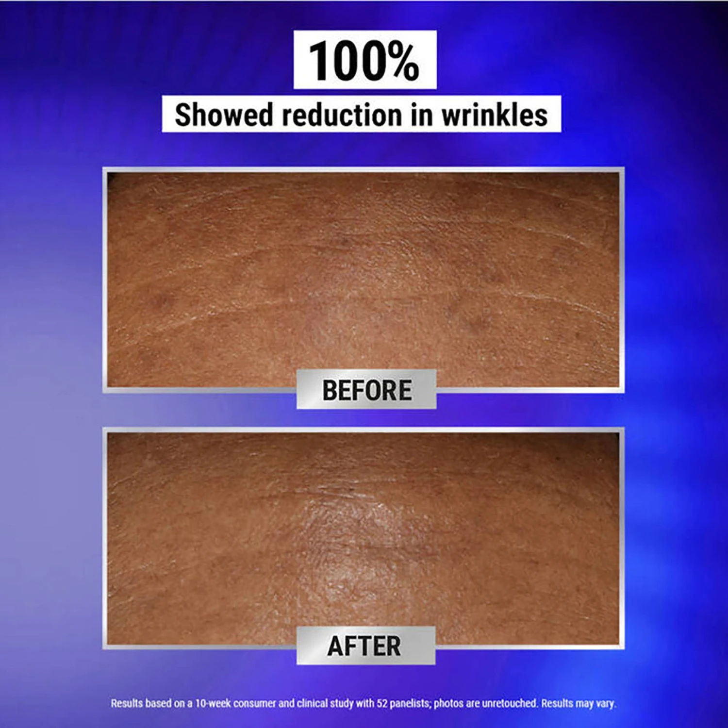 Kiehl's Fast Release Wrinkle-Reducing Retinol Night Serum 6 Kiehl's Fast Release Wrinkle-Reducing Retinol Night Serum - Image 4