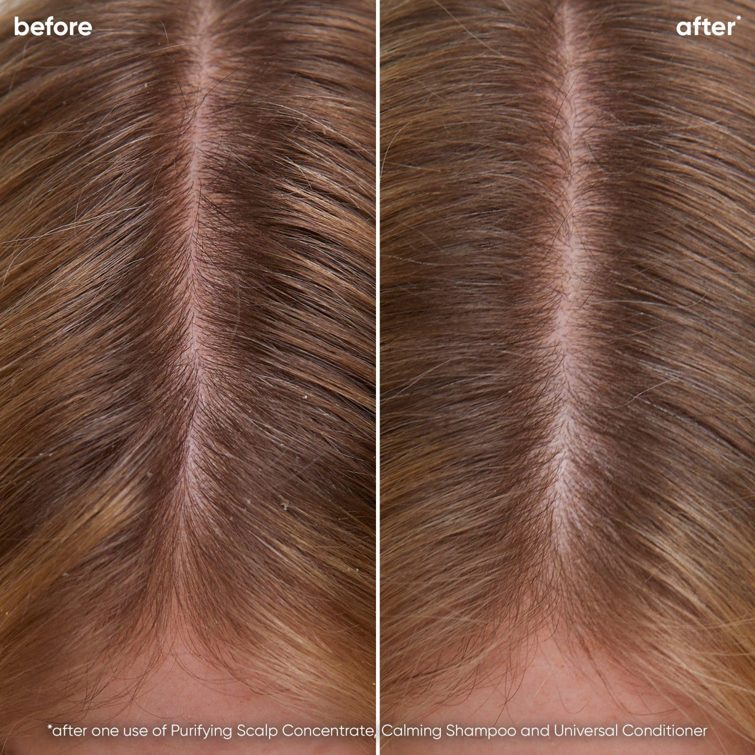 Matrix Biolage Scalp Sync Calming Shampoo 5 Matrix Biolage Scalp Sync Calming Shampoo - Image 3