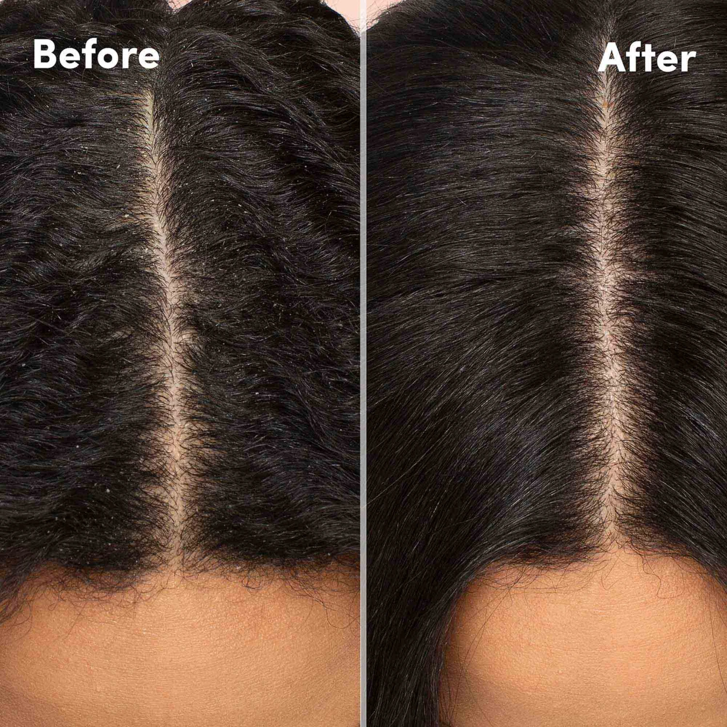 Mizani Scalp Care Calming Lotion 6 Mizani Scalp Care Calming Lotion - Image 4