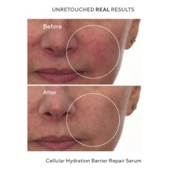 Murad Cellular Hydration Repair Serum 10 Murad Cellular Hydration Repair Serum -Bumble Sale Store Murad Cellular Hydration Repair Serum 3