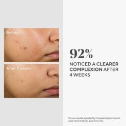 Murad Clarifying Water Gel Moisturizer -Bumble Sale Store Murad Water Gel Moisturizer 3