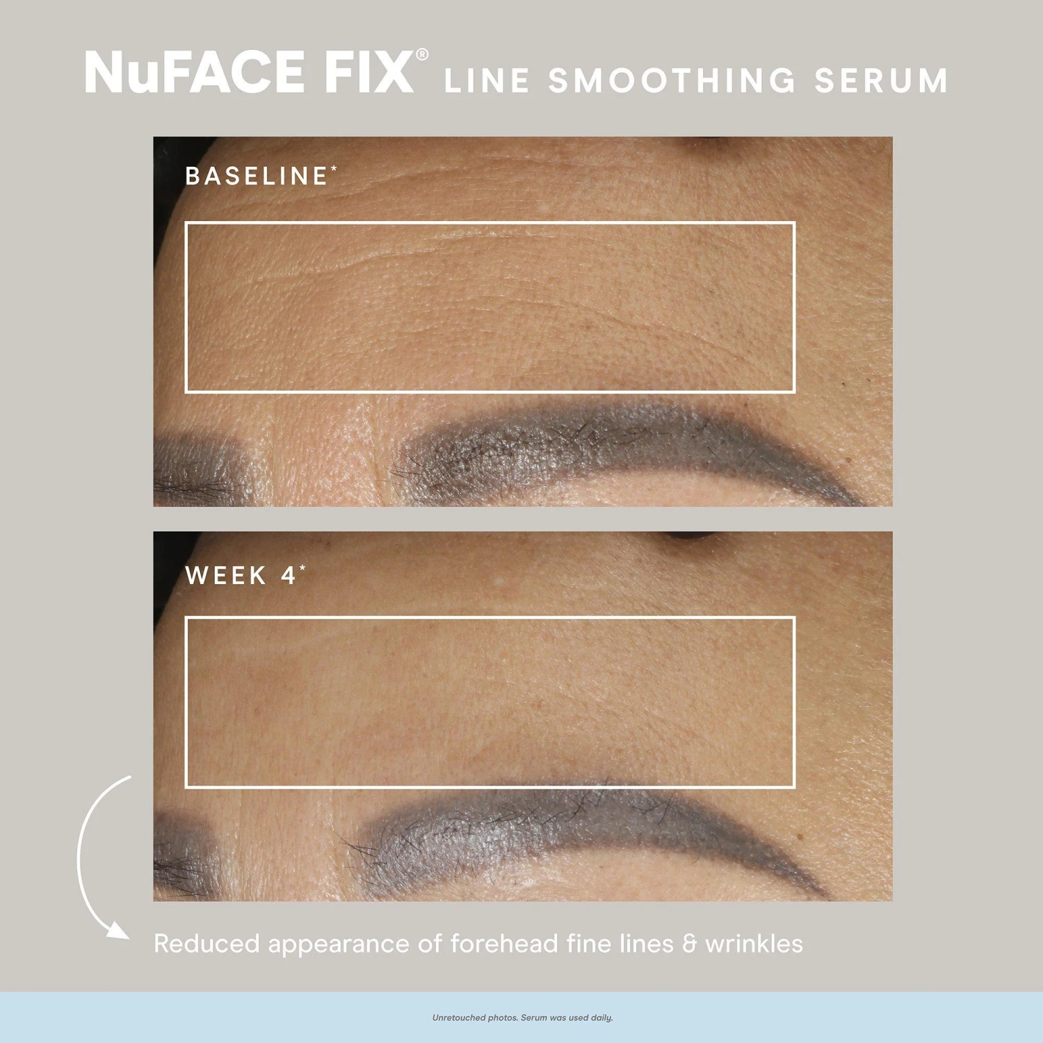 NuFace Fix Smoothing Serum 10 NuFace Fix Smoothing Serum - Image 8