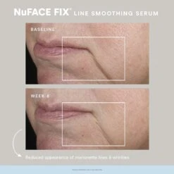 NuFace Fix Smoothing Serum 16 NuFace Fix Smoothing Serum -Bumble Sale Store NuFace Fix Smoothing Serum 3