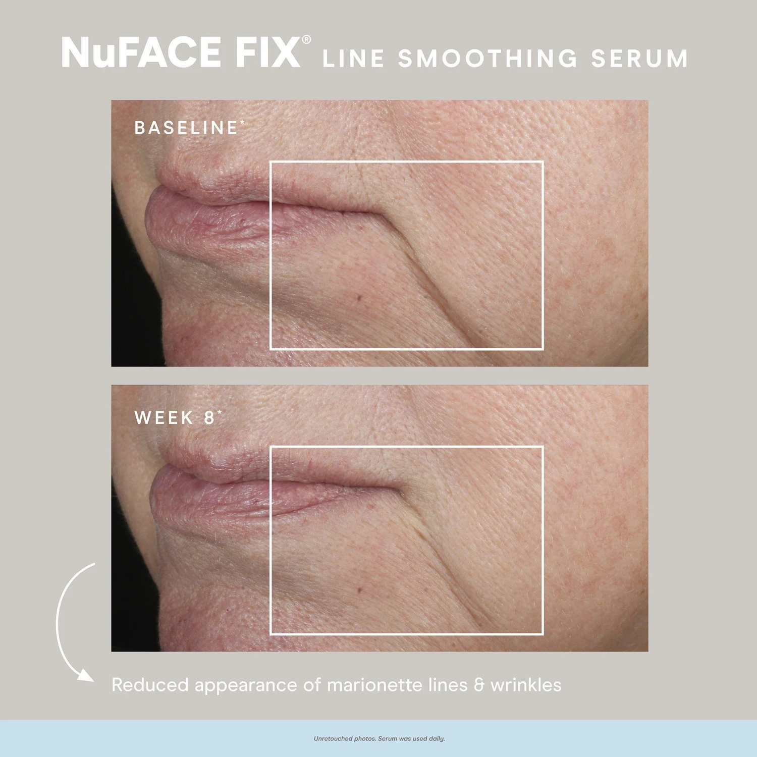 NuFace Fix Smoothing Serum 9 NuFace Fix Smoothing Serum - Image 7