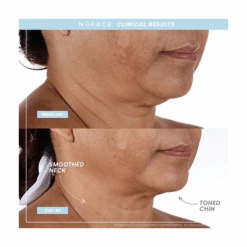 NuFace Mini+ Sandy Rose -Bumble Sale Store Nuface Mini Pink 3 cdda8264 9502 40cc 8bc5 1307b32ff160