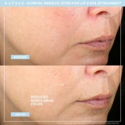 NuFace Trinity+ Complete Set - WITH Wrinkle Reducer & Effective Lip+Eye Attachments -Bumble Sale Store Nuface Trinity Complete Set 1