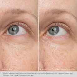 Obagi Daily-Hydro Drops Rejuvenating Eye Gel Cream -Bumble Sale Store Obagi Daily Hydro Drops Rejuvenating Eye Gel Cream 4