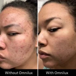 Omnilux Clear -Bumble Sale Store Omnilux Clear 7